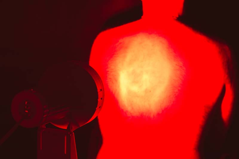 Infra-Red light treatment